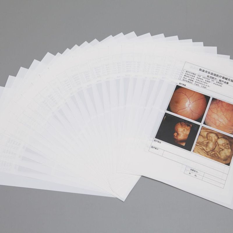 Transparent and Semi-Transparent Medical Dry Ultrasound Film Inkjet Film