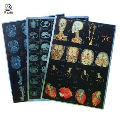 215um Pet Inkjet Print Blue Dry X Ray Medical Film