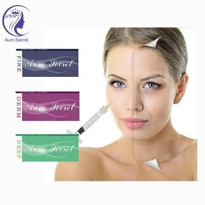 Hyaluronic Acid Based Dermal Filler Deep Derm Line Syringe Collagen Injection for Lip