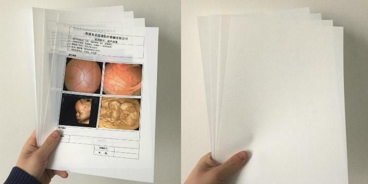 Long Shelf Life, Quick Roomlight Loading Medical Laser Imaging Film