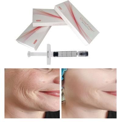 Injectable Hyaluronic Acid Facial Filler Cross-Linked Hyaluronic Acid for Face