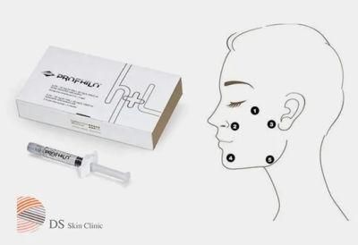 Profhilo Skin Booster Hyaluronic Acid Dermal Filler