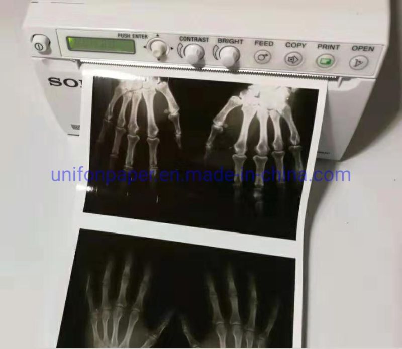 Medical Video Printing Paper USG Ultrasound Thermal Roll Upp-110hg for Sony