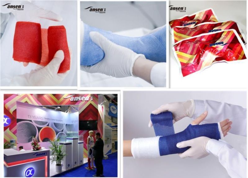 Free Sample Fiberglass Orthopedic Casts Medical Consumable Bone Fixation Bandage Fiberglass Casting Tape Manufacturers