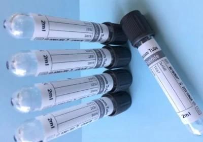 ESR Vacuum Collection Test Tube with Sodium Citrate