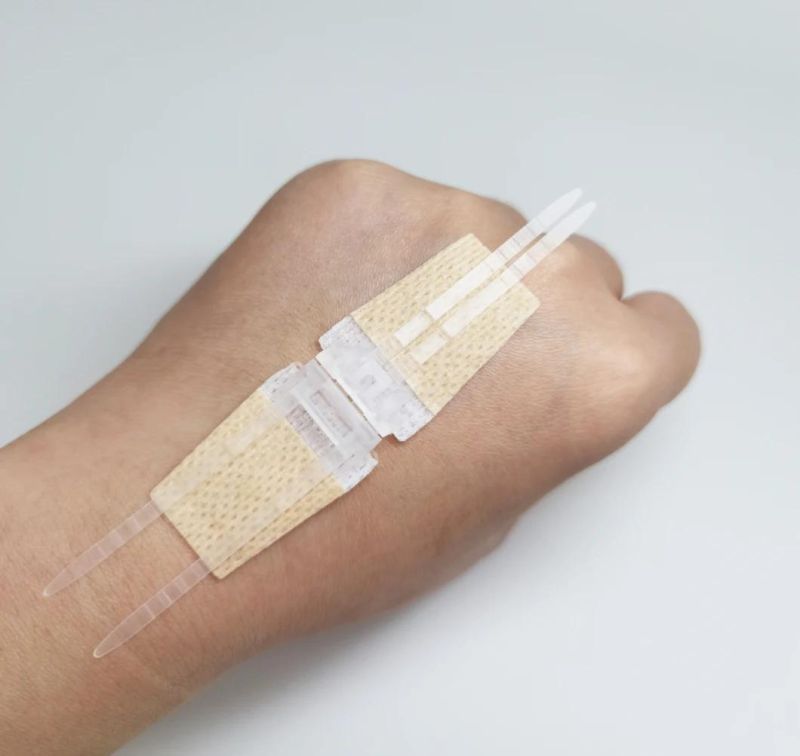 Surgical Wound Closure Plaster, Adhesive Wound Closure Device