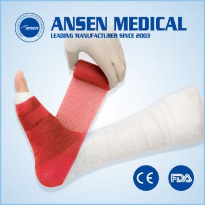 Hospital Use Disposable Waterproof Fiberglass Orthopedic Casting Bandage