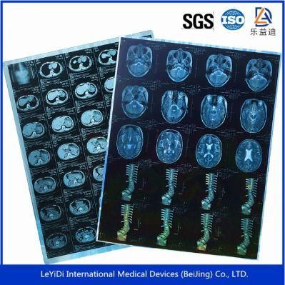 Leyidi Medical X Ray Film Blue Sensitive Films