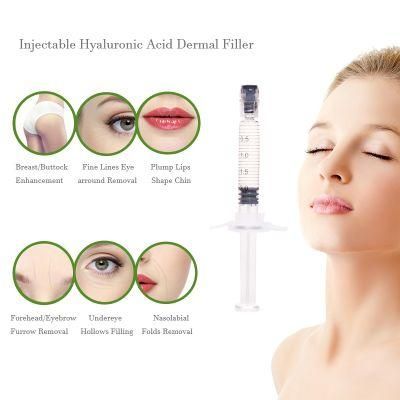 Hyaluronic Acid Dermal Filler for Cheekbones Chins Jawlines Smile Lines