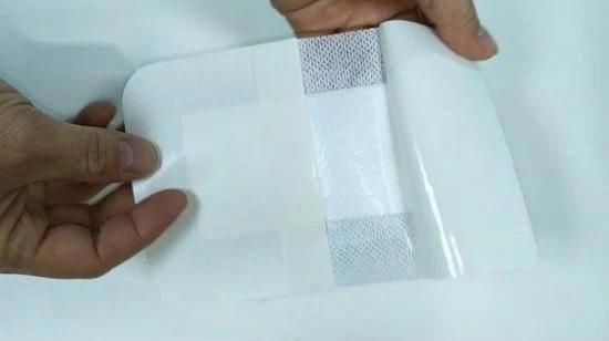 Mdr CE Approved Nonwoven Fabric Surgical Medical Adhesive Dressing for Hospital