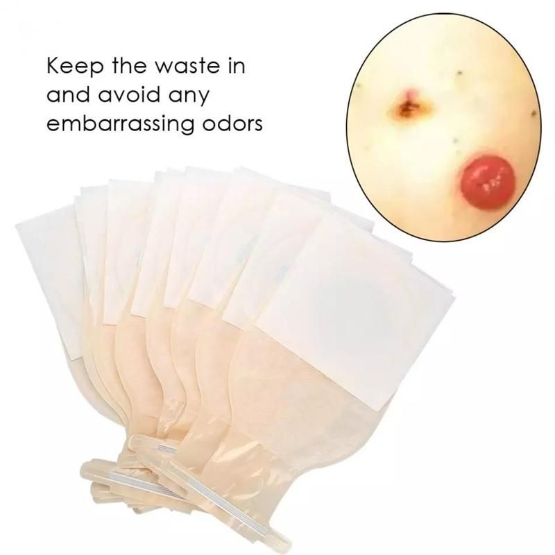 High Quality New Style 57mm 70mm Size Opend Stoma Medical Disposable Ostomy Colostomy Bag