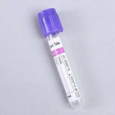 Fast Shipping Collection Sample Test Tube Vacuum Blood Tube