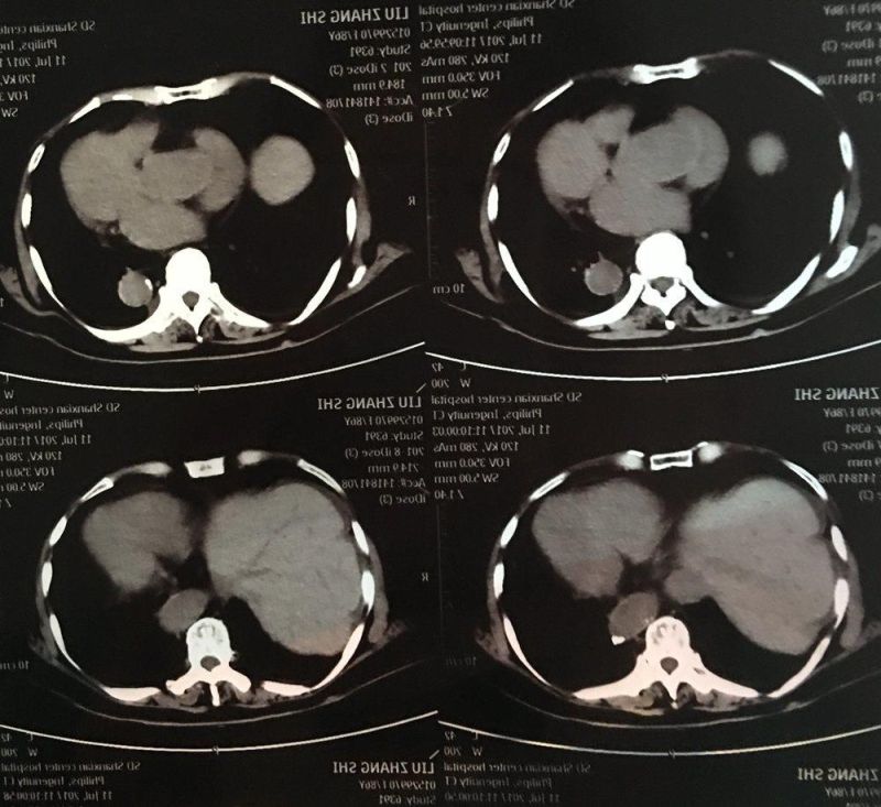 Dr Imaging System Using Inkjet Medical X Ray Films