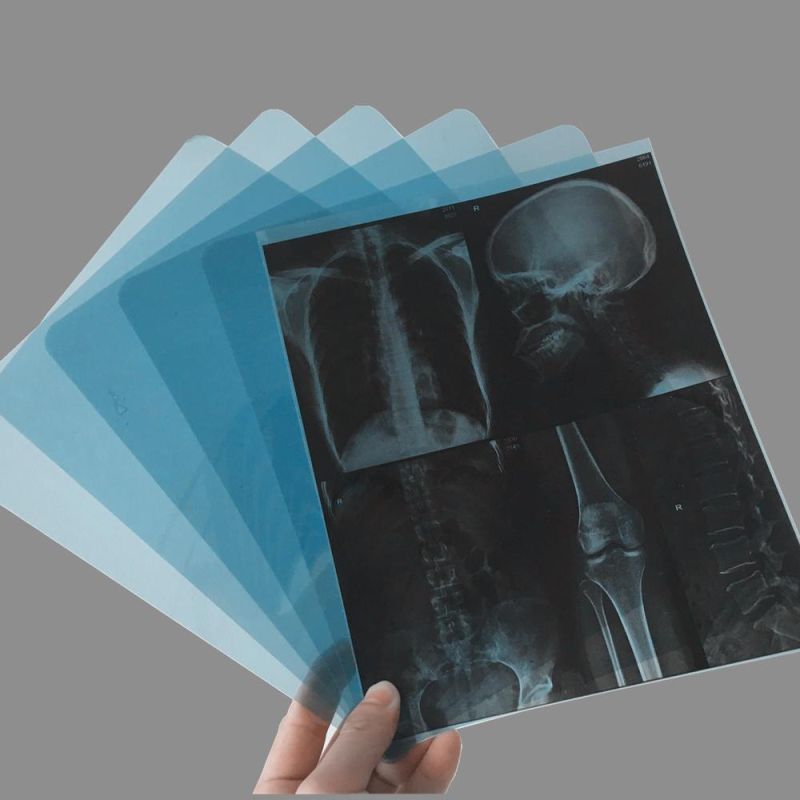 Radiology Medical Dry Film/Dry Thermal Film 35X43 Cm