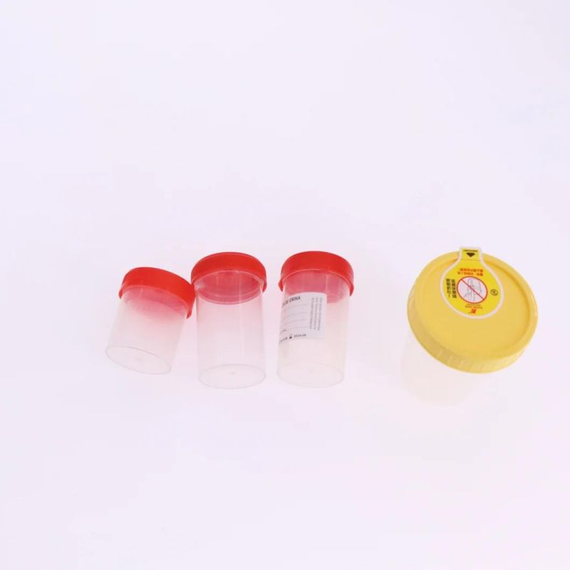 Disposable Urine Cup Vacuum Urine Specimen Container Cup