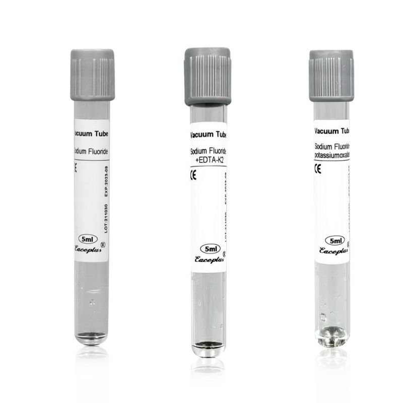 Siny Vacuum Blood Collection Tubes Sodium Fluoride Tube Glucose Tube