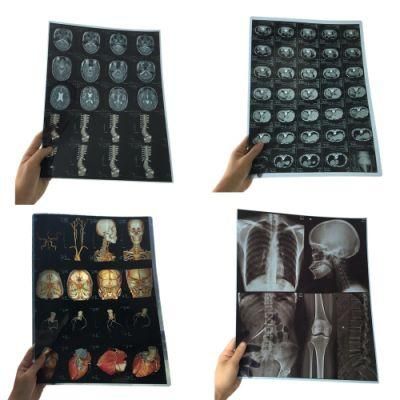 Inkjet Printing Medical Dry X-ray Film for Epson/Canon Printer