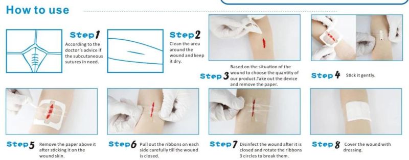 Disposable Medical Zipstitch Zip Wound Closure Device Without Stitches