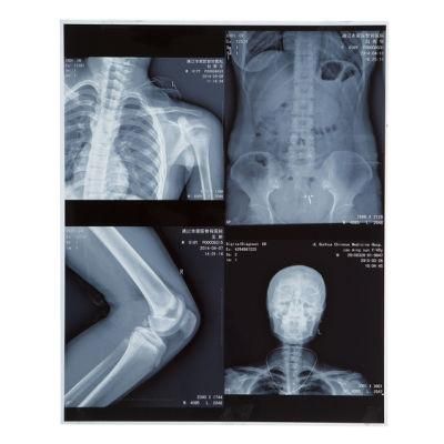 ISO 13485 Approved White Inkjet CT/MRI Medical Film