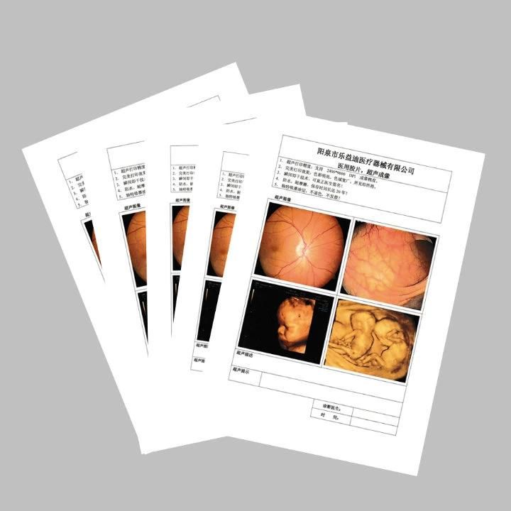 Chinese Ultrasound Department and Radiology Department Medical X-ray Dry Film