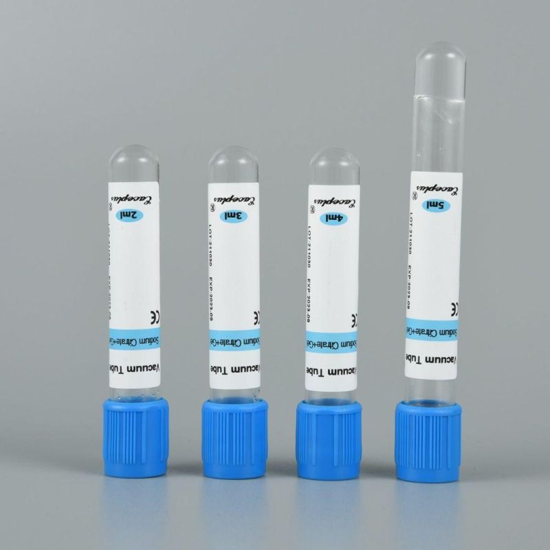 Siny Gel&Sodium Citrate Blue Vacuum Blood Collection PT Tube