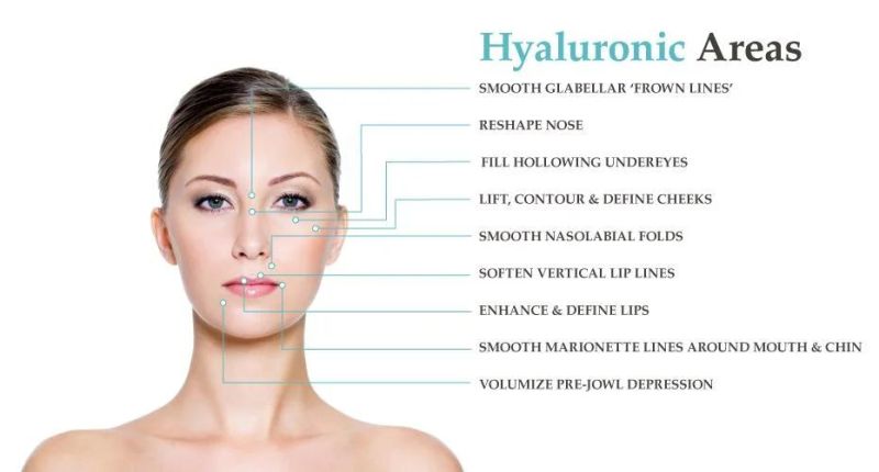 Injectable Sodium Hyaluronate Dermal Filler Cross Linked Hyaluronic Acid for Face Lip Breast Buttocks Penis Enhancement Facial Wrinkle Chin Cheeks Ha Injection