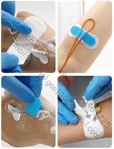 Medical Disposable IV Cannula Film Dressing for Catheter Securement Factory