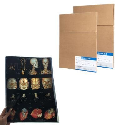 8X10 and 14X17 Universal Inkjet X Ray Film