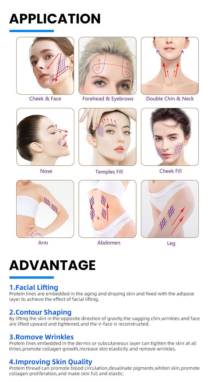 CE Cosmetic Grade Needle Pdo Thread