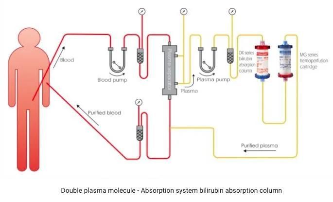 Highly Specific Bilirubin Absorption Column