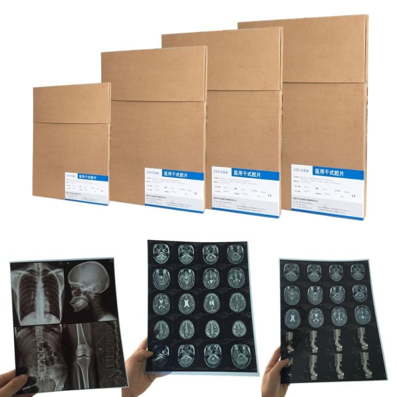 11X14 and A3 Dicom Inkjet Printing Ultrasound/Radiology Films