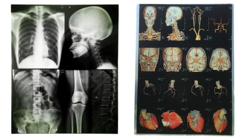 14*17 and 8*10 Inch Blue Thermal X-ray Dry Films