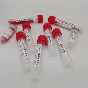 Factory Direct Disposable Vtm Tube Universal Virus Sampling Collection Tube Viral Transport Medium Test Tube