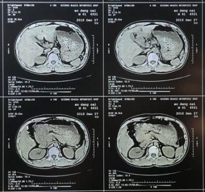 Inkjet X Ray Blue Film Medical Dry Film Bulk Medical Supplies