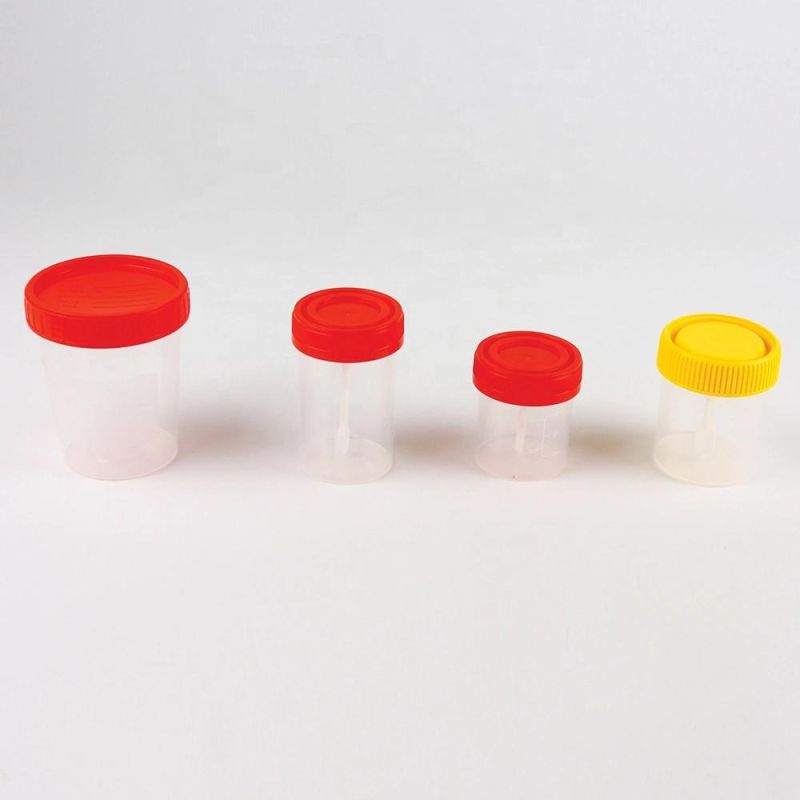 Sterile Disposable Plastic 150ml Urine Test Sample Specimen Collection Container with Screw Cap