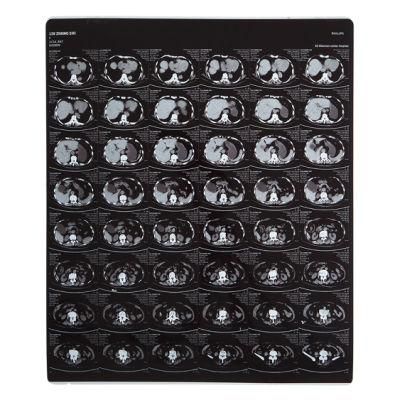 Medical Dry Film X-ray Film 210 Microns Inkjet Film Blue