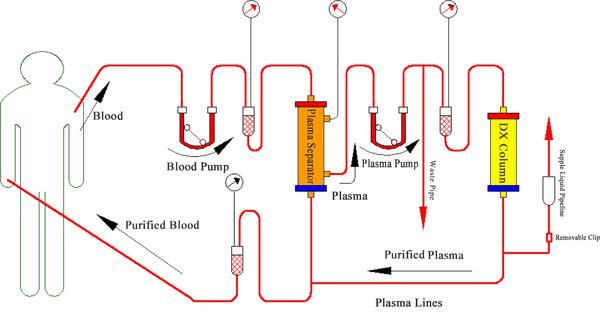 Adsorbent Volumn 350ml Bilirubin Adsorption Column