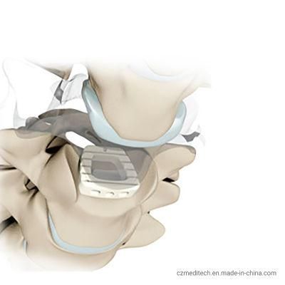 Medical Products Spine Implants Cervical Fusion Medical Cage