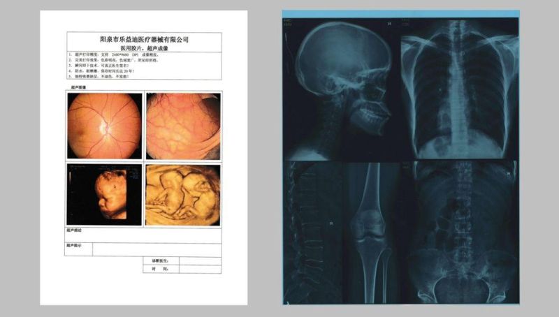 Laser Image Medical X-ray Film for FUJI Xerox Drypix 3500 Printer