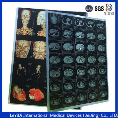 Hospital Use Radio Graphic Medical X-ray Film Imaging