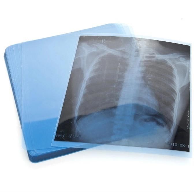 3D 8X10 Inch Inkjet Medical X-ray Films