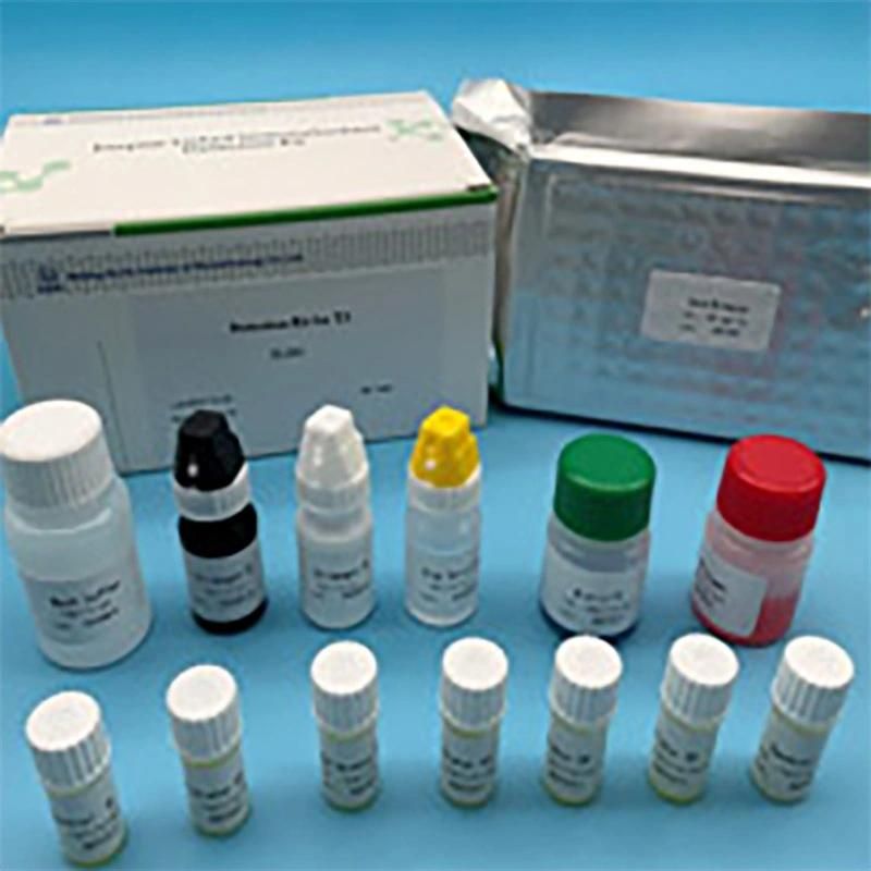 Hbcab Elisa Test Kit/Hepatitis B Surface Antigen Elisa Hospital Detection Test Reagent