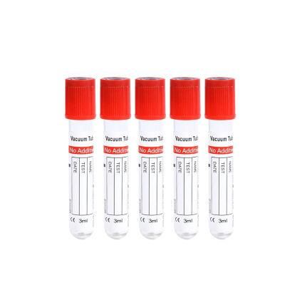 Vacuum Blood Test Tube