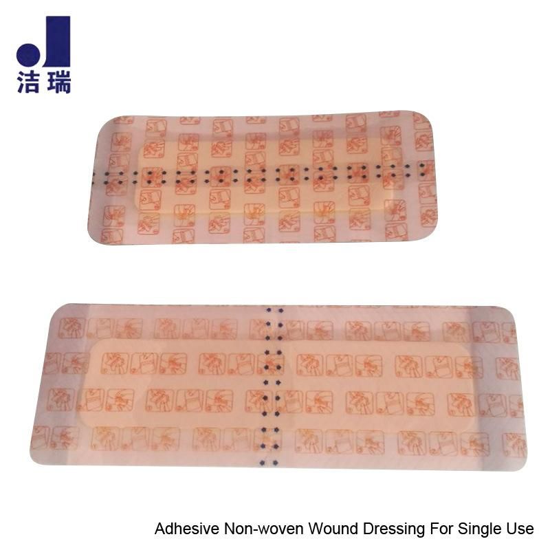 Wound Dressing