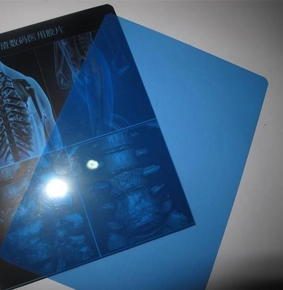 Hospital Inkjet Film for Screen Printing X-ray Films