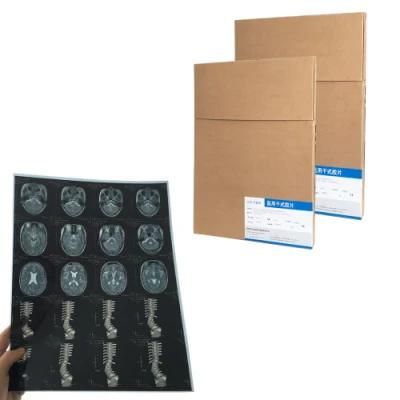 Inkjet Based Medical X Ray Blue Films 14*17 Inch