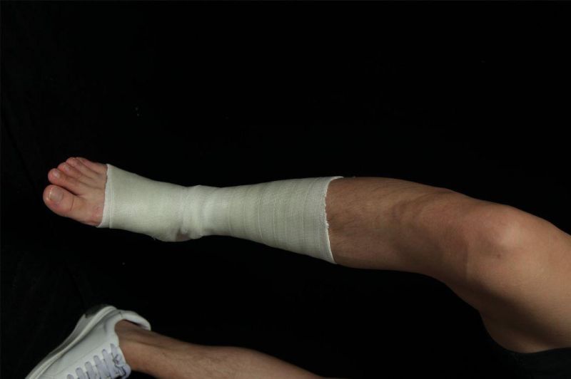 Fiberglass Orthopedic Splint Elastic Bandage for Ankle Joint Fractured Bone External Fixation