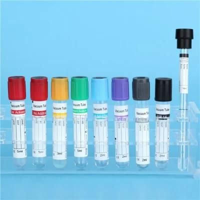 Vacuum Blood Collection Glucose /PT Tube/Clot Activator/EDTA/ESR Tube