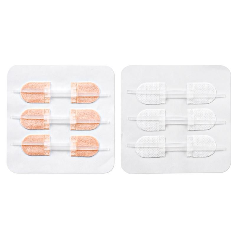 Special Hot Selling Medical Products Surgical Wound Suture Patch Zipper Type