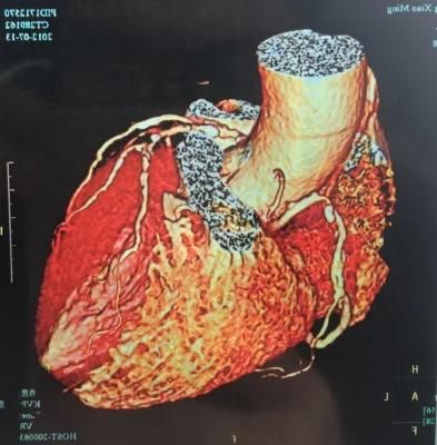 Chinese Ultrasound Department and Radiology Department Medical X-ray Dry Film